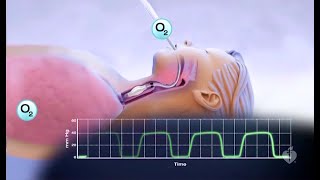 Capnography Made Easy [upl. by Ianaj954]