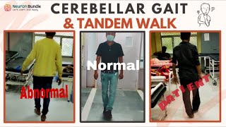 Cerebellar Ataxia Gait Abnormal TandemWalk neurology widebasegait tandemgait meded [upl. by Savick]