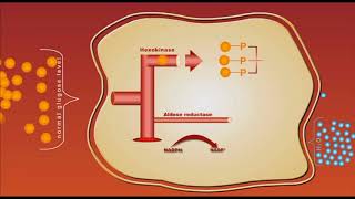 Diabetes complication Sorbitol animation [upl. by Ramor]