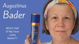 Using Augustinus Bader On Half My Face For 12 Months  Did It Help [upl. by Zelde991]