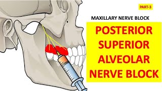 PSA POSTERIOR SUPERIOR ALVEOLAR NERVE BLOCK Oral surgery Nerve blocks Maxillary blockdental [upl. by Darrey]