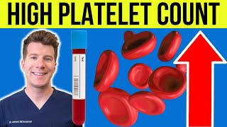 Doctor explains HIGH PLATELET COUNT Thrombocytosis  Causes symptoms and more [upl. by Liss]