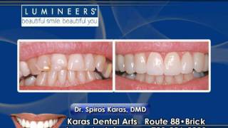 Straighter Whiter Teeth with Karas Dental amp Lumineers [upl. by Berns]