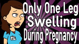 Only One Leg Swelling During Pregnancy [upl. by Tarsus]