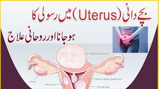 Bachedani Uterus Mein Rasoli Ka Ho jana  Rasoli Ko Khatam Karne Ka Rohani Ilaj  Dua Program [upl. by Narhet]