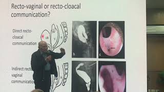 Radiological interpretation of cloacal MRI images by professor Alberto penia [upl. by Ardnas]