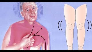 Ces 6 symptômes vous avertissent que vous pouvez avoir une crise cardiaque le mois prochain [upl. by Ecydnarb]