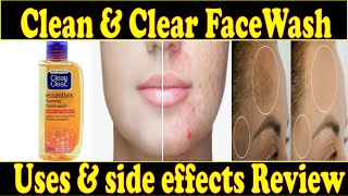 Clean amp Clear Face Wash Review😢  Uses amp Side Effects  Honest Review  Ayeshaa Naeem❤ [upl. by Jump]