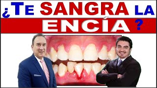 ENCÍAS SANGRANTES SANGRADO GINGIVAL O DE ENCÍAS CAUSA Y DIAGNÓSTICO [upl. by Igal]