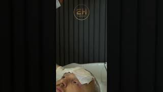 hairtransplantturkey hairtransplantistanbul shortvideo hairstyles short esthetichairturkey [upl. by Lamaj]