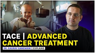 Advance Cancer Treatment  CHEMOTHERAPY  TACE  Liver cancer treatment  Dr Gaurav Gangwani [upl. by Ailemaj331]