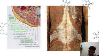 Anatomi Dinding Abdomen [upl. by Rustice]