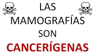 Las Mamografias son Cancerigenas [upl. by Nirahs]