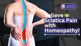 Sciatica  Dr Sham Sundar  Sciatica Homeopathy Treatments [upl. by Acinelav]