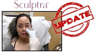 SCULPTRA UPDATE  SEREIN WU [upl. by Hilarius]