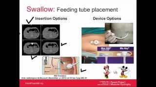 Duchenne Pulmonary Care for Adults Webinar November 2014 [upl. by Ordisi]