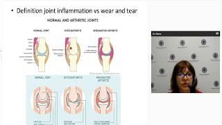 Diagnosing and managing psoriatic arthritis [upl. by Othilie]