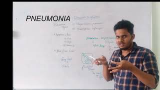 HUMAN HEALTH and DiseasestamilPNEUMONIA BACTERIAL DISEASESneet [upl. by Noira11]