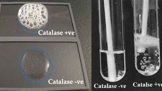 Catalase test [upl. by Patience302]