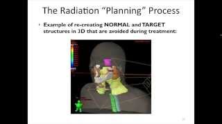 Late Stage Oropharynx Cancer Planning Radiotherapy [upl. by Anderea]