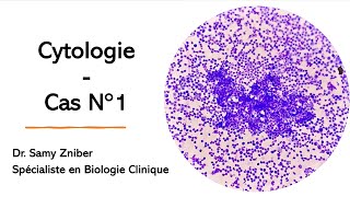 🔬Cytologie  Anomalies Morphologiques dans le Frottis Sanguin et le Myélogramme 🔬 [upl. by Perr547]