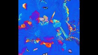 Histidine Histamine Tissue Growth and Repair Myelin Sheath Radiation Heavy Metals Blood Cells [upl. by Parish]