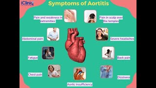 Aortitis Symptoms and Causes  Diagnosis  Treatment  Prevention [upl. by Dylana]