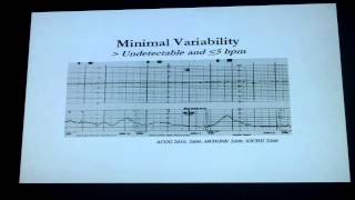 Fetal monitoring review 2 part I [upl. by Aneeram]