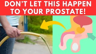 6 SHOCKING Secrets About Prostate Health That You’ve NEVER Heard Before 😱 [upl. by Carola]