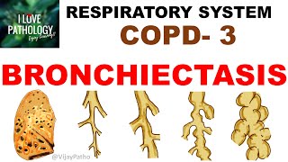 Chronic Obstructive Pulmonary Disease Part 3 Bronchiectasis  Pathology [upl. by Federico]