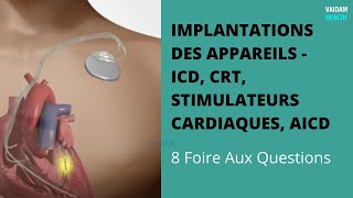 IMPLANTATIONS DES APPAREILS  ICD CRT stimulateurs cardiaques AICD 8 Foire Aux Questions [upl. by Larentia785]