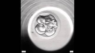 Development of an Embryo from 2PN to Blastocyst via an EmbryoScope [upl. by Emrich]