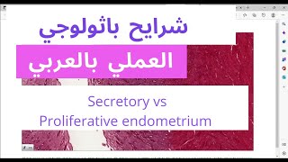 Secretory phase vs Proliferative phase endometrium  histology slide review [upl. by Aronek14]