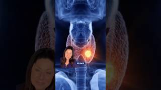 Thyroid Nodules Season 2  Part 2 My Benign Thyroid Nodule is Growing  Whats Nextquot [upl. by Whyte985]