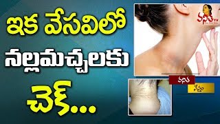 Home Remedies to Get Rid of Dark Neck in Summer  Beauty Tips  Vanitha Tips  Vanitha TV [upl. by Husch]