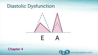 Echocardiography Diastolic Dysfunction Measurement with Demonstration [upl. by Sile223]