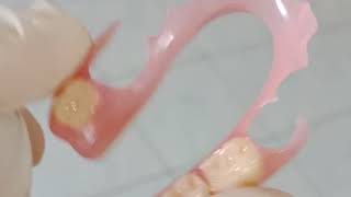 Valplast Flexible Denture [upl. by Nosbig]