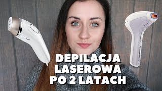 Depilacja laserowa IPL po 2 latach Czy się OPŁACA [upl. by Enyrhtak]