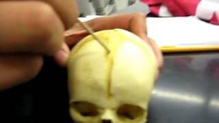 Fetal Skull Skeletal System [upl. by Merrie]