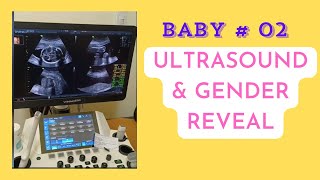 Ultrasound and Gender Result [upl. by Enajyram]