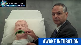 Flexible Bronchoscopy Introduction 8  Awake Intubation Part 1 [upl. by Ablem966]