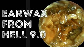 Earwax From HELL 90🔥🔥 [upl. by Hairej]