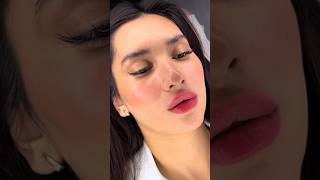 Вторичная контурная пластика губ 💉 Stylage M  0 8 ml 👄 filler косметология [upl. by Alilak19]