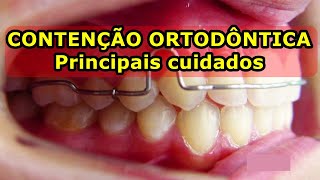 Cuidados com a Contenção Ortodôntica  quais são necessários [upl. by Trudnak183]