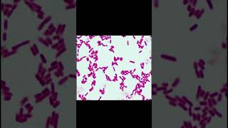 Gram negative bacilli microscopy staining microbiology gnb viral [upl. by Anirahtak]