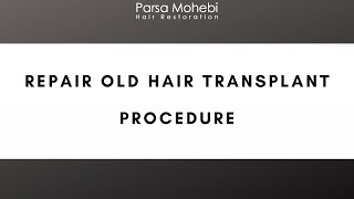 Repair Old Hair Transplant Procedure with Dr Parsa Mohebi [upl. by Leirej429]