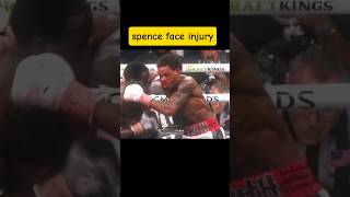 Errol spence vs crowford spencevscrawford spence crawford boxing fyp davis [upl. by Lauraine440]