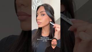 How To Transform Your Face with Botox  Surgeon Reacts [upl. by Taryne]