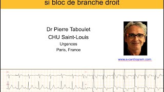 4g Bloc de branche droit 3 ischémie aiguë et infarctus P Taboulet [upl. by Adnomal]