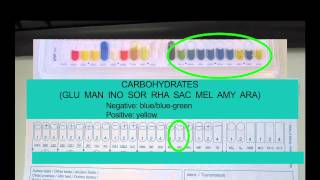 Microbiology Using API Strips 3 [upl. by Waers647]